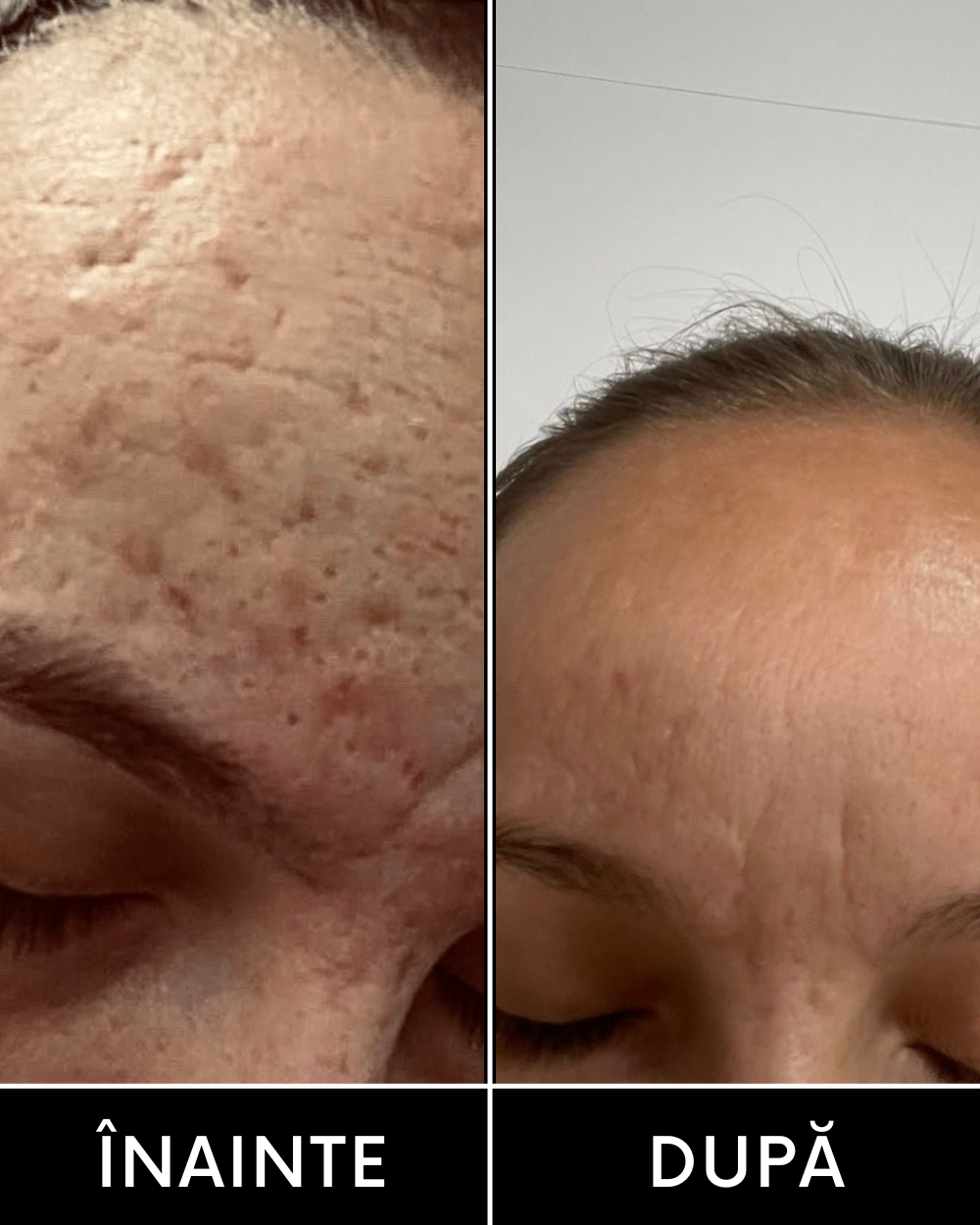 CREMA RETINOL & ACID HIALURONIC