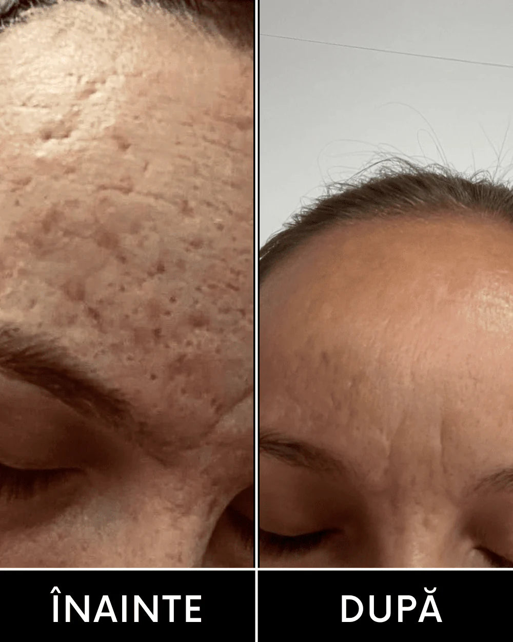 CREMA RETINOL & ACID HIALURONIC